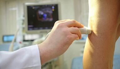 Lasersko zdravljenje varikoznih žil