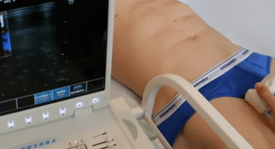 Diagnostične možnosti za krčne žile spodnjih okončin